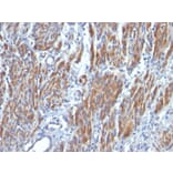 Immunohistochemistry - Anti-MYH11 Antibody [SMMS-1] (A249459) - Antibodies.com