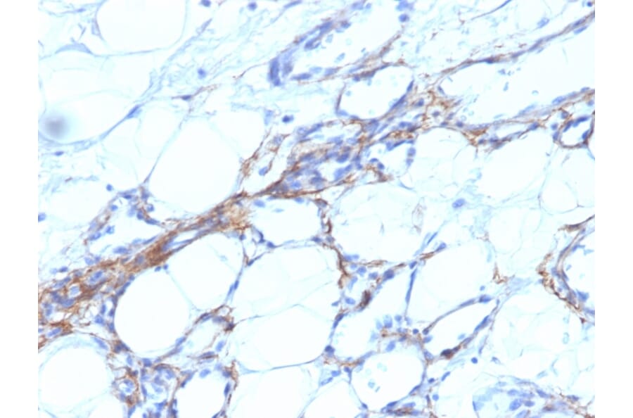 Immunohistochemistry - Anti-MYH11 Antibody [SPM201] (A249459) - Antibodies.com