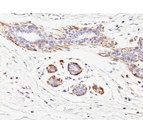 Immunohistochemistry - Anti-MYH11 Antibody [MYH11/923] (A249462) - Antibodies.com