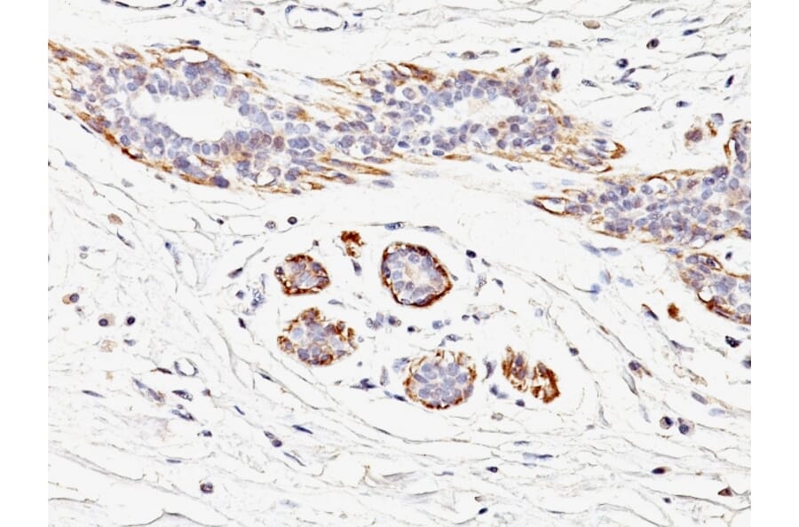 Immunohistochemistry - Anti-MYH11 Antibody [MYH11/923] (A249462) - Antibodies.com
