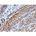 Immunohistochemistry - Anti-MYH11 Antibody [MYH11/923] (A249462) - Antibodies.com