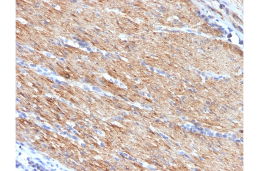 Immunohistochemistry - Anti-MYH11 Antibody [MYH11/923] (A249462) - Antibodies.com