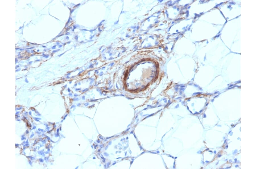 Immunohistochemistry - Anti-MYH11 Antibody [MYH11/923] (A249461) - Antibodies.com