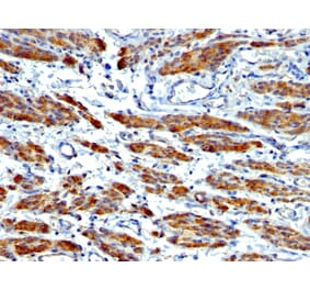 Immunohistochemistry - Anti-MYH11 Antibody [MYH11/923 + SMMS-1] (A249463) - Antibodies.com