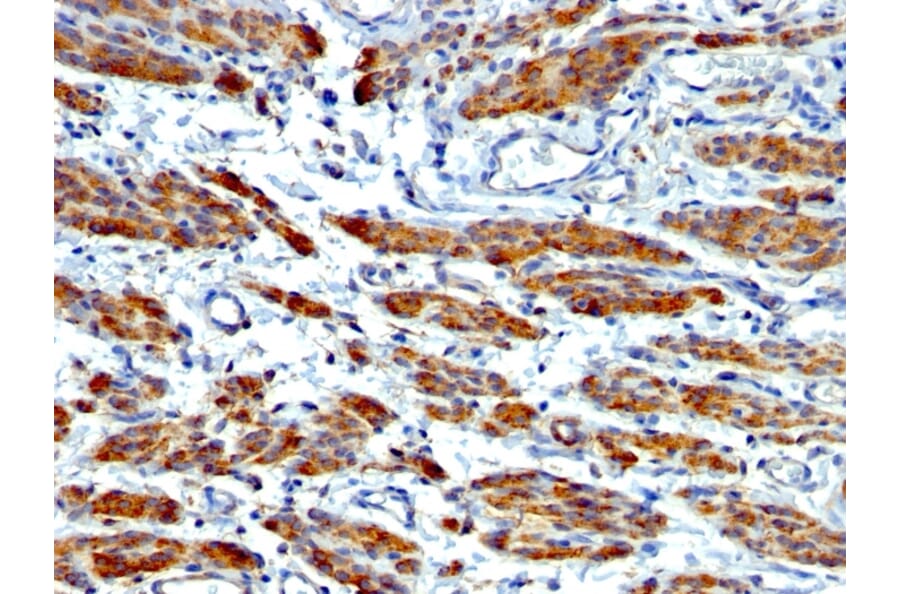 Immunohistochemistry - Anti-MYH11 Antibody [MYH11/923 + SMMS-1] (A249463) - Antibodies.com