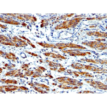 Immunohistochemistry - Anti-MYH11 Antibody [MYH11/923 + SMMS-1] (A249463) - Antibodies.com