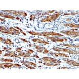 Immunohistochemistry - Anti-MYH11 Antibody [MYH11/923 + SMMS-1] (A249463) - Antibodies.com