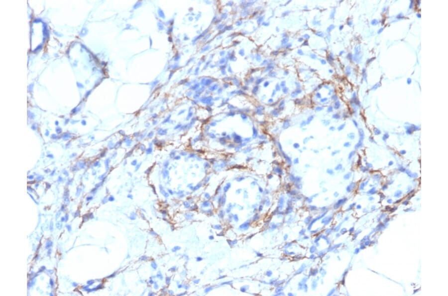 Immunohistochemistry - Anti-MYH11 Antibody [MYH11/923 + SMMS-1] (A249462) - Antibodies.com