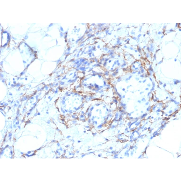Immunohistochemistry - Anti-MYH11 Antibody [MYH11/923 + SMMS-1] (A249462) - Antibodies.com