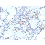 Immunohistochemistry - Anti-MYH11 Antibody [MYH11/923 + SMMS-1] (A249462) - Antibodies.com