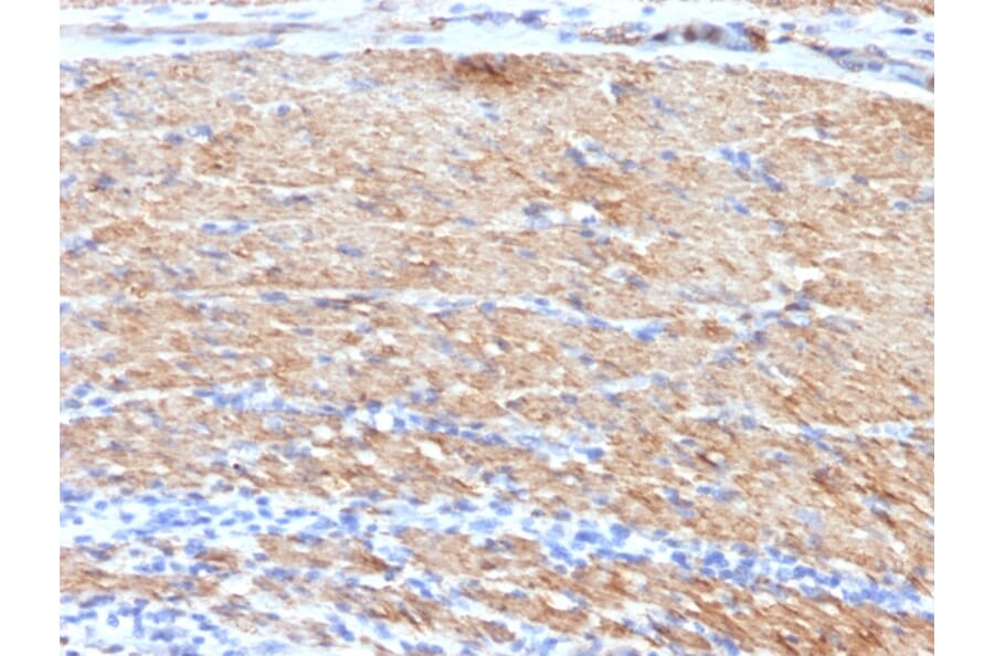 Immunohistochemistry - Anti-MYH11 Antibody [MYH11/923 + SMMS-1] (A249463) - Antibodies.com