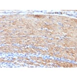 Immunohistochemistry - Anti-MYH11 Antibody [MYH11/923 + SMMS-1] (A249463) - Antibodies.com