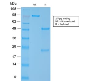 SDS-PAGE - Anti-MYH11 Antibody [MYH11/2303R] (A249464) - Antibodies.com