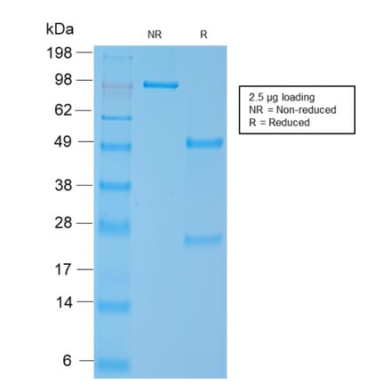 SDS-PAGE - Anti-MYH11 Antibody [MYH11/2303R] (A249464) - Antibodies.com