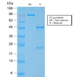 SDS-PAGE - Anti-MYH11 Antibody [MYH11/2303R] (A249464) - Antibodies.com