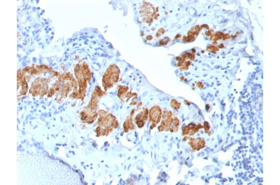 Immunohistochemistry - Anti-MYH11 Antibody [MYH11/2303R] (A249464) - Antibodies.com