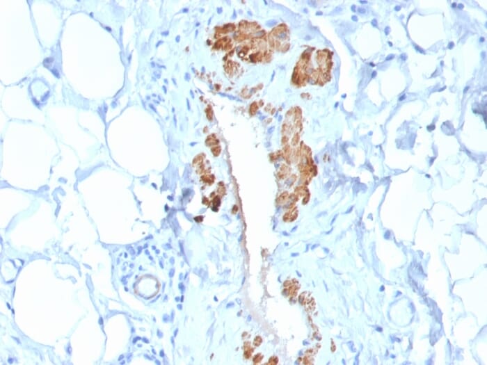 Recombinant Anti-MYH11 Antibody [MYH11/2303R] (A249464)