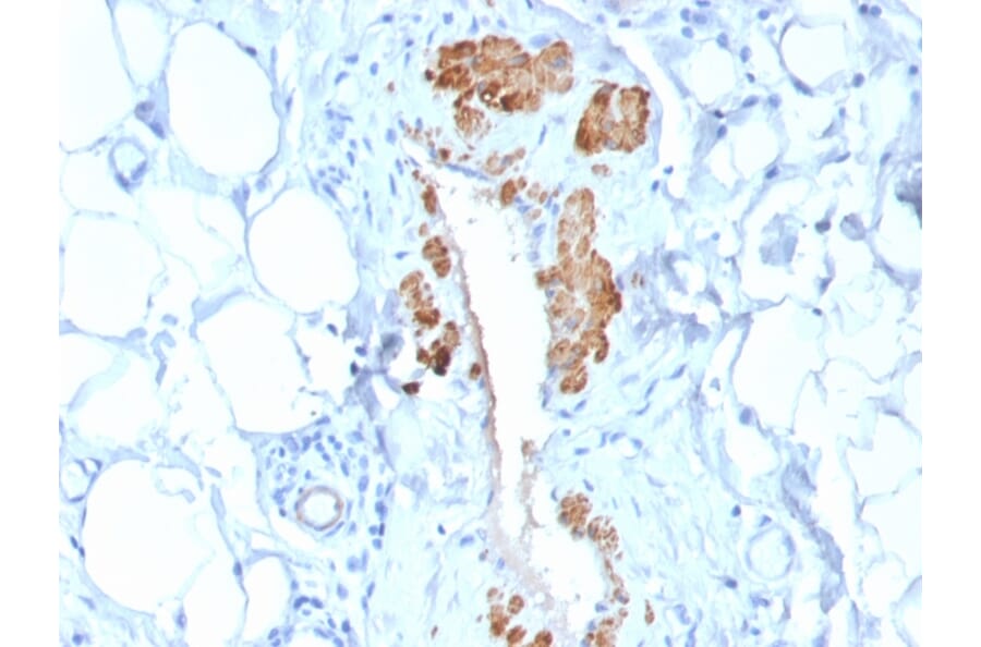 Immunohistochemistry - Anti-MYH11 Antibody [MYH11/2303R] (A249463) - Antibodies.com
