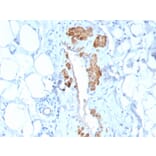 Immunohistochemistry - Anti-MYH11 Antibody [MYH11/2303R] (A249463) - Antibodies.com