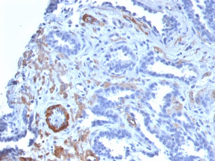 ma様 Recombinant Anti-MYH11 Antibody [MYH11/2303R] (A249464)