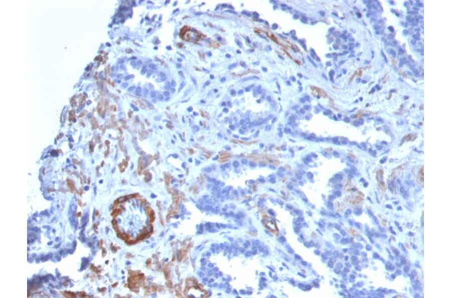 Immunohistochemistry - Anti-MYH11 Antibody [MYH11/2303R] (A249464) - Antibodies.com
