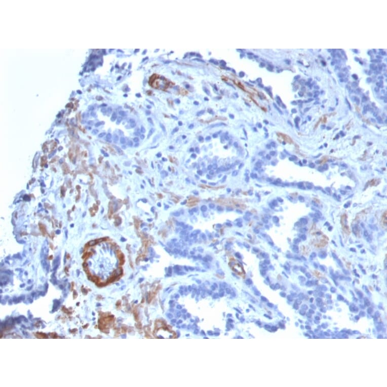 Immunohistochemistry - Anti-MYH11 Antibody [MYH11/2303R] (A249464) - Antibodies.com