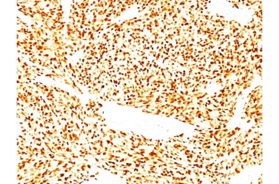 Immunohistochemistry - Anti-MyoD1 Antibody [SPM427] (A249464) - Antibodies.com
