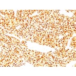 Immunohistochemistry - Anti-MyoD1 Antibody [SPM427] (A249464) - Antibodies.com