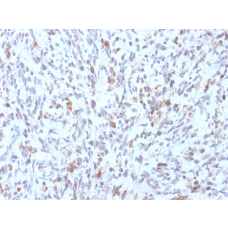 Immunohistochemistry - Anti-MyoD1 Antibody [rMYD712] (A249466) - Antibodies.com