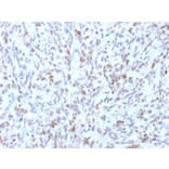 Immunohistochemistry - Anti-MyoD1 Antibody [rMYD712] (A249466) - Antibodies.com