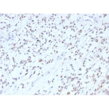 Immunohistochemistry - Anti-MyoD1 Antibody [MYOD1/2075R] (A249467) - Antibodies.com