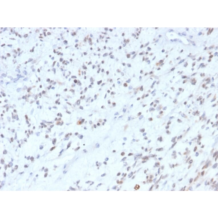 Immunohistochemistry - Anti-MyoD1 Antibody [MYOD1/2075R] (A249467) - Antibodies.com