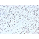 Immunohistochemistry - Anti-MyoD1 Antibody [MYOD1/2075R] (A249467) - Antibodies.com