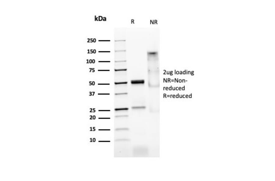 SDS-PAGE - Anti-MyoD1 Antibody [MYOD1/2075R] (A249467) - Antibodies.com