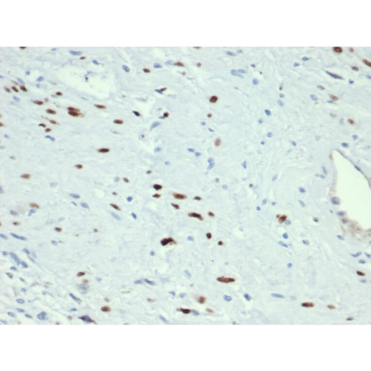 Immunohistochemistry - Anti-MyoD1 Antibody [MYOD1/3418R] (A249468) - Antibodies.com