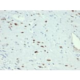 Immunohistochemistry - Anti-MyoD1 Antibody [MYOD1/3418R] (A249468) - Antibodies.com