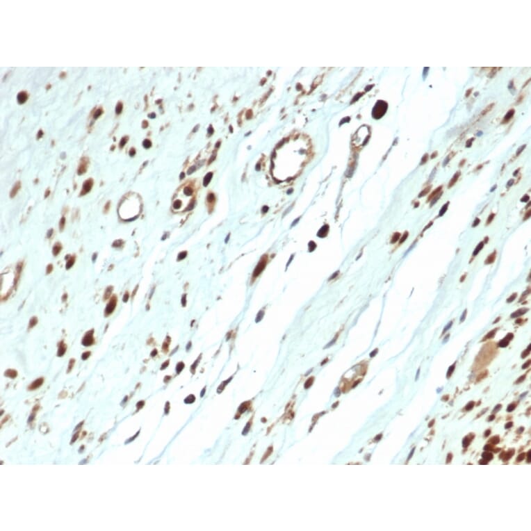 Immunohistochemistry - Anti-MyoD1 Antibody [MYOD1/3418R] (A249467) - Antibodies.com