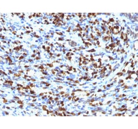 Immunohistochemistry - Anti-Myogenin Antibody [MGN185] (A249468) - Antibodies.com