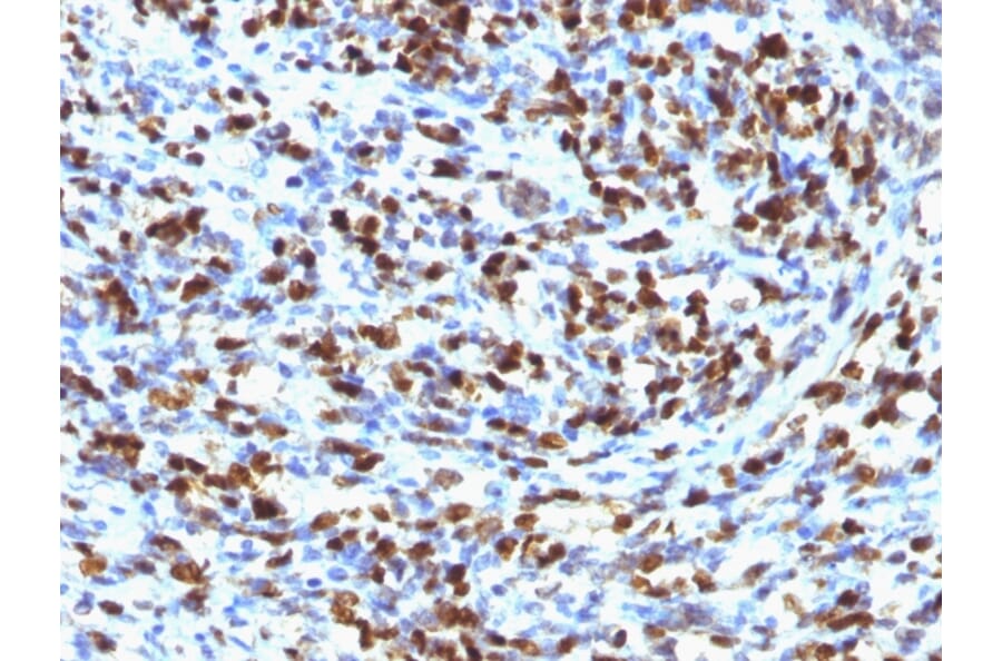 Immunohistochemistry - Anti-Myogenin Antibody [MGN185] (A249468) - Antibodies.com