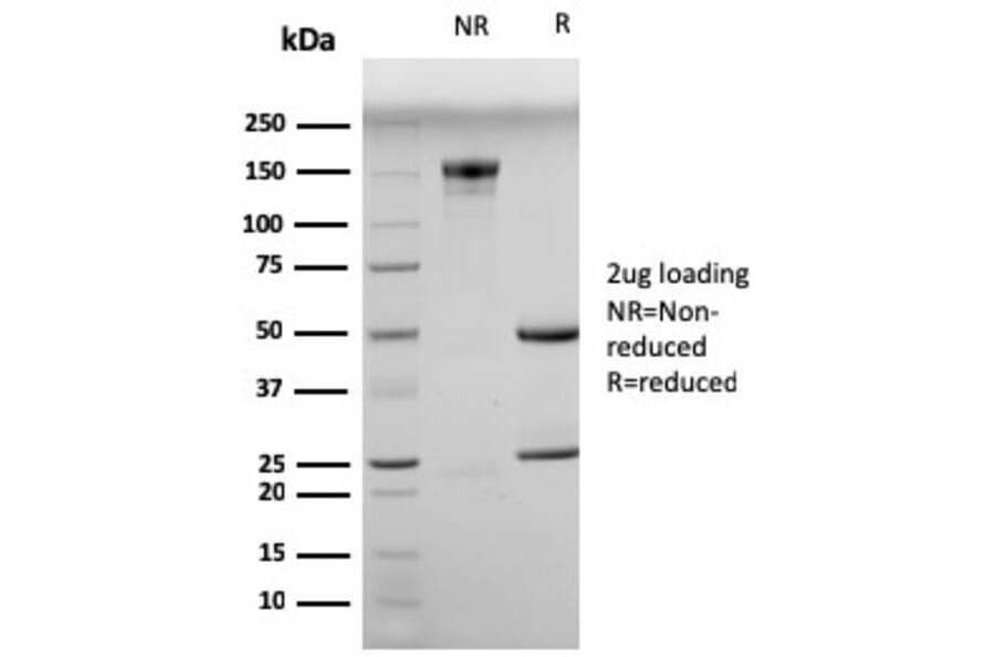 SDS-PAGE - Anti-Myogenin Antibody [MGN185] (A249469) - Antibodies.com