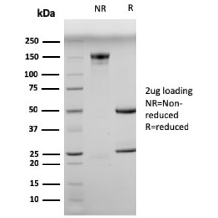 SDS-PAGE - Anti-Myogenin Antibody [MGN185] (A249469) - Antibodies.com
