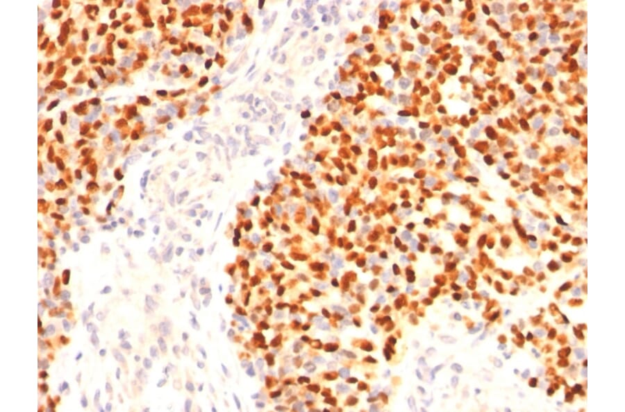 Immunohistochemistry - Anti-Myogenin Antibody [F5D] (A249469) - Antibodies.com