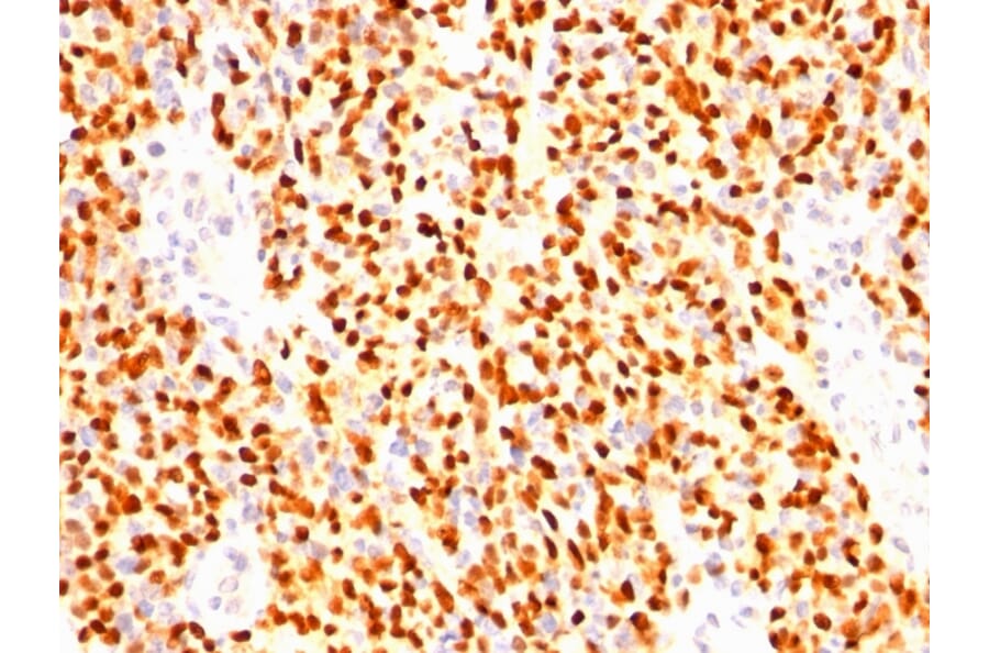 Immunohistochemistry - Anti-Myogenin Antibody [SPM144] (A249470) - Antibodies.com