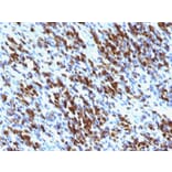 Immunohistochemistry - Anti-Myogenin Antibody [MGN185 + F5D] (A249471) - Antibodies.com