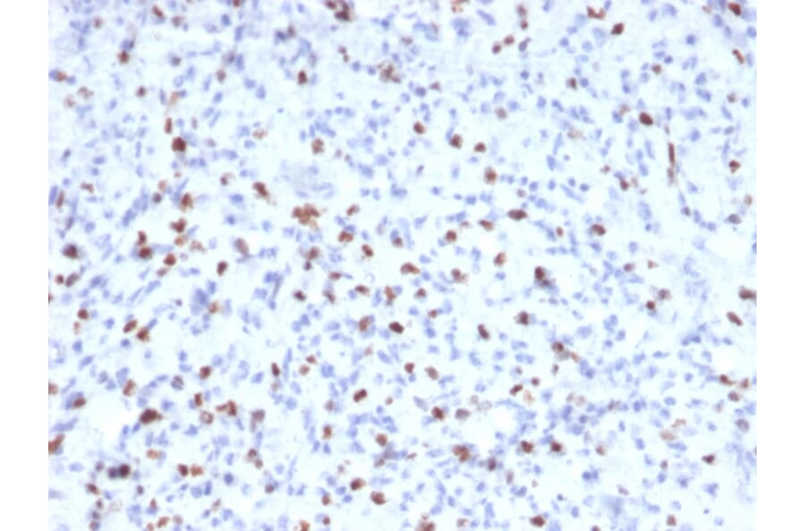 Immunohistochemistry - Anti-Myogenin Antibody [MYOG/2660] (A249473) - Antibodies.com