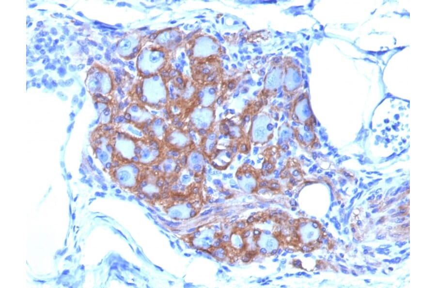Immunohistochemistry - Anti-NCAM1 Antibody [SPM128] (A249475) - Antibodies.com
