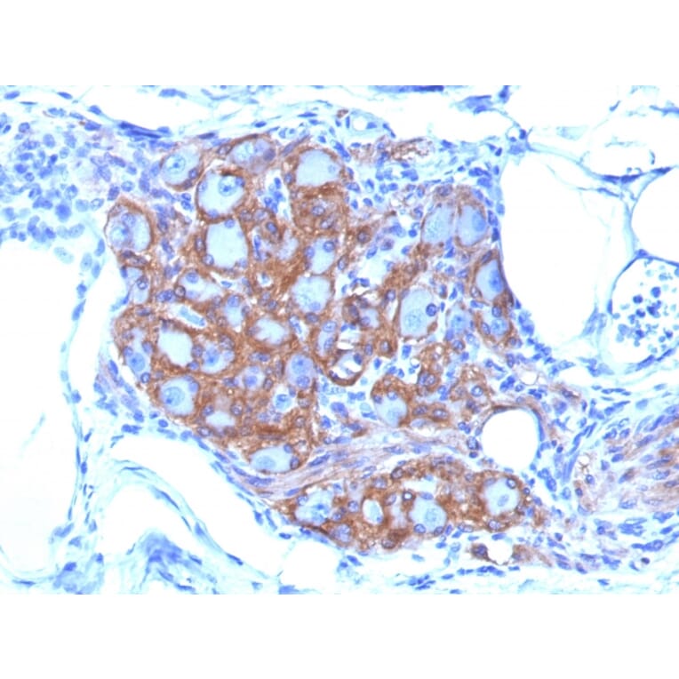 Immunohistochemistry - Anti-NCAM1 Antibody [SPM128] (A249475) - Antibodies.com