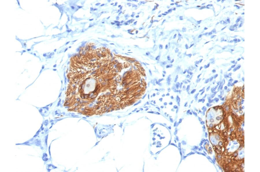 Immunohistochemistry - Anti-NCAM1 Antibody [123A8] (A249475) - Antibodies.com