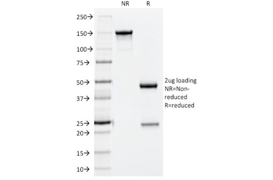SDS-PAGE - Anti-NCAM1 Antibody [123A8] (A249476) - Antibodies.com