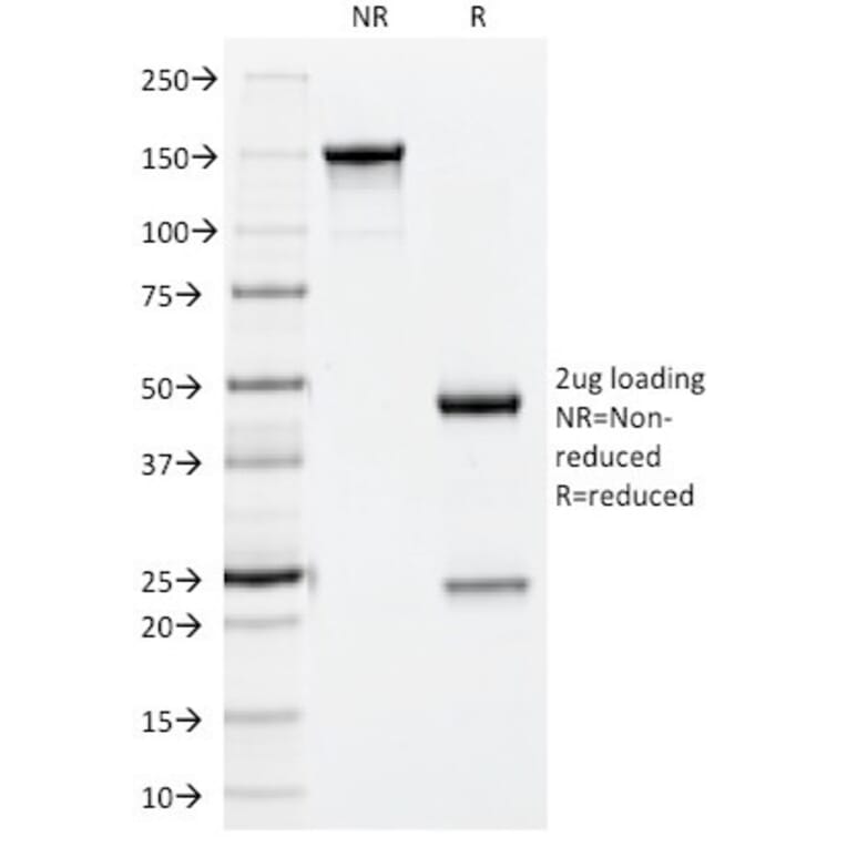 SDS-PAGE - Anti-NCAM1 Antibody [123A8] (A249476) - Antibodies.com